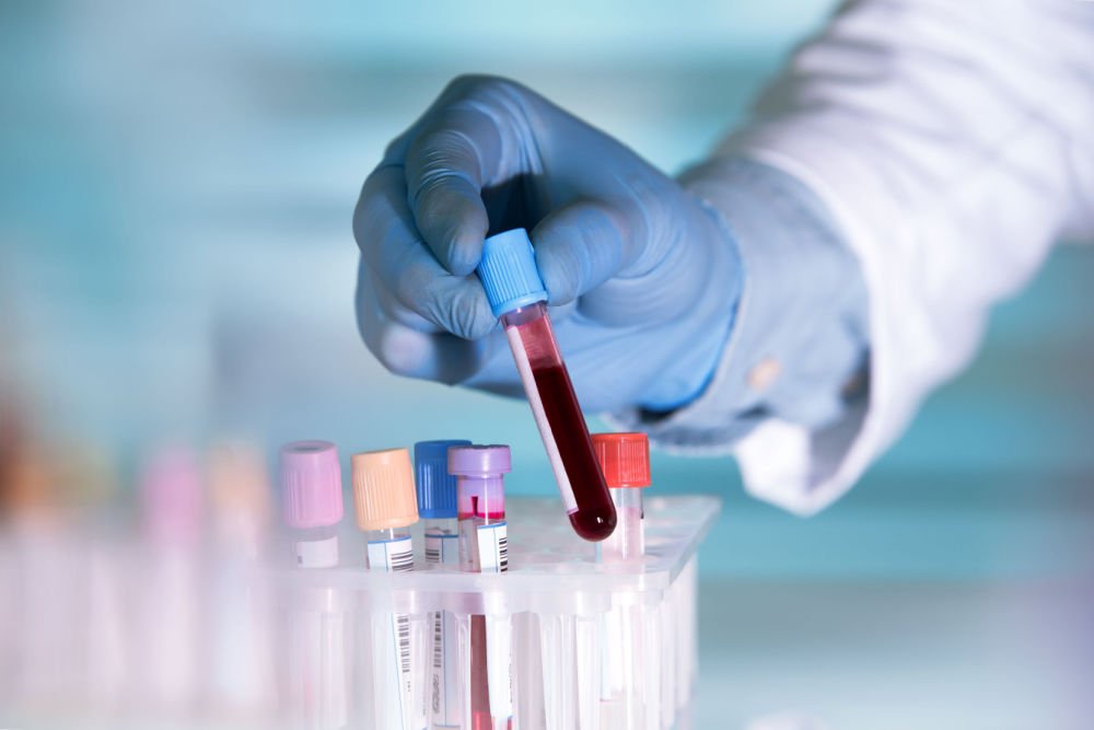 Why a Relatively Small Funder Made a Big Donation to Study Neglected Diseases