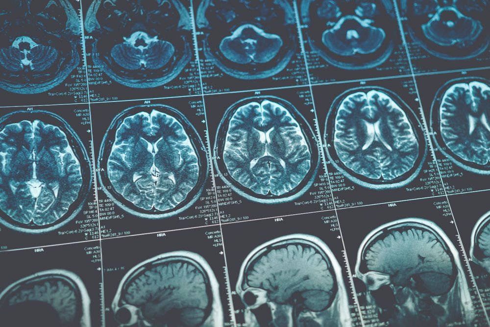 CZI’s Grant for Diversity in Neuroscience is a Positive Development. Is it Part of a Larger Trend?