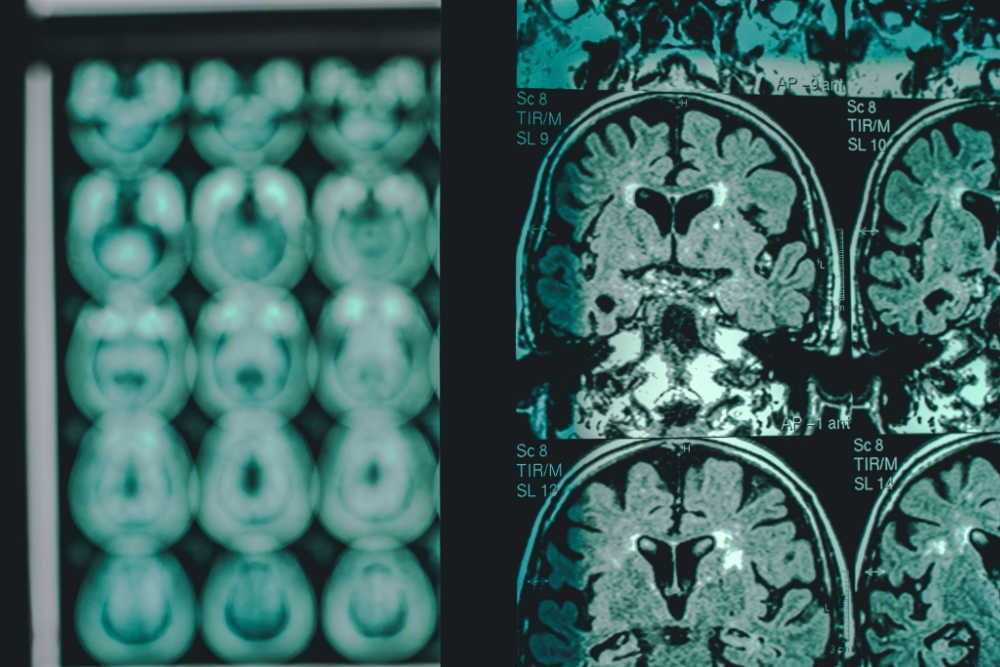 “Explore the Gaps.” A Closer Look at the Kavli Foundation’s Neuroscience Grantmaking