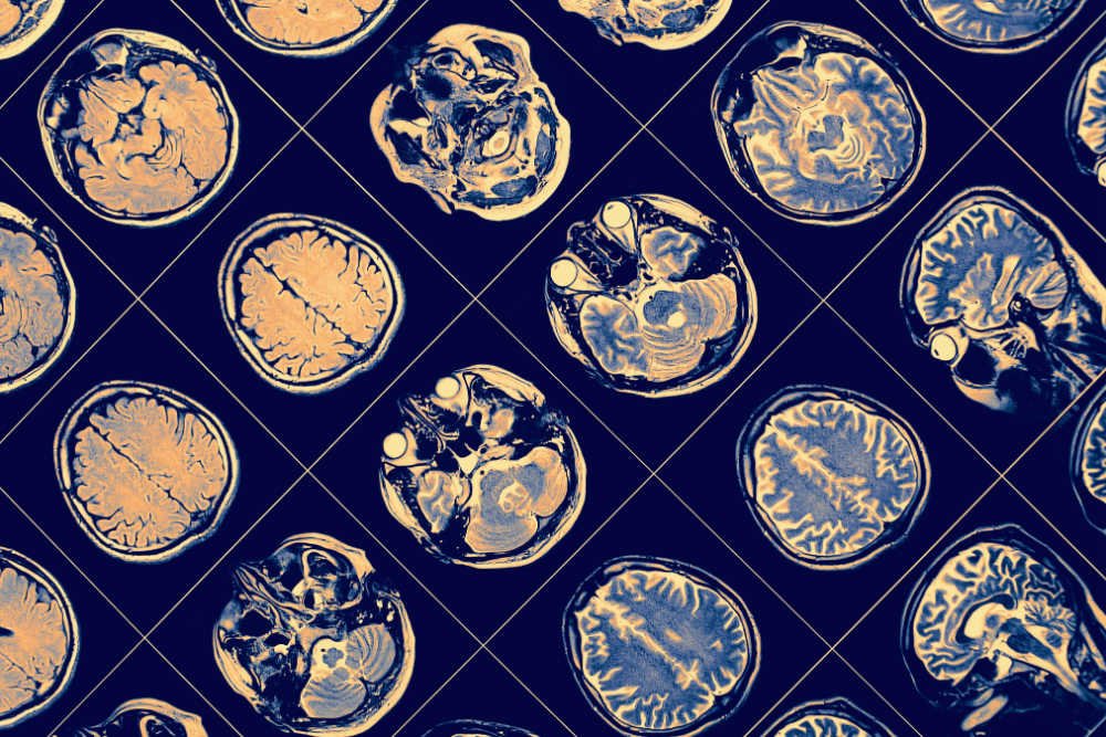 Of Mice and Men: How Paul Allen’s Giving Set the Stage for an Ambitious Effort to Map the Human Brain